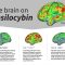 Study advances efforts to harness psilocybin’s mind-altering power to treat mental illness