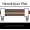 Hemodialysis Kinetics 101 02 The Hemodialysis Filter